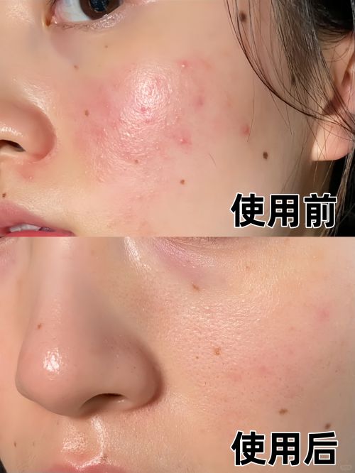 霜十大适合追求年轻肌肤的人AG旗舰厅网站首页抗皱面(图6)