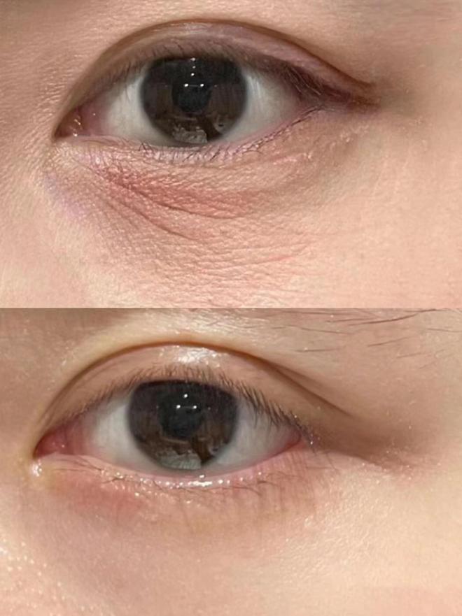 主打一个选对不选贵口碑高的眼霜揭秘AG旗舰厅网站去眼袋第一名的眼霜！(图3)